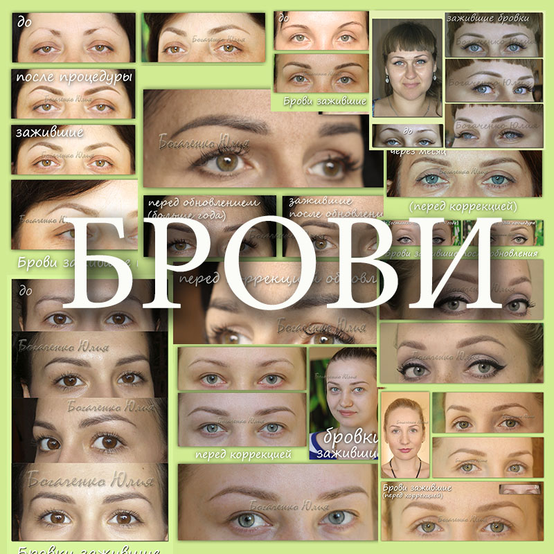 Брови